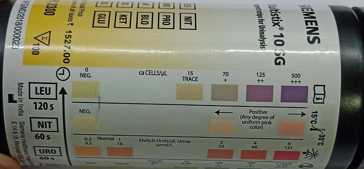 Urine Leukocyte Esterase Test Clinical Laboratory Guide 8621