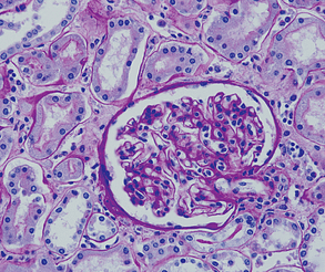 Basement membrane demonstration in Renal biopsy by PAS