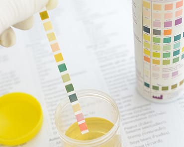 nitrite test in urine