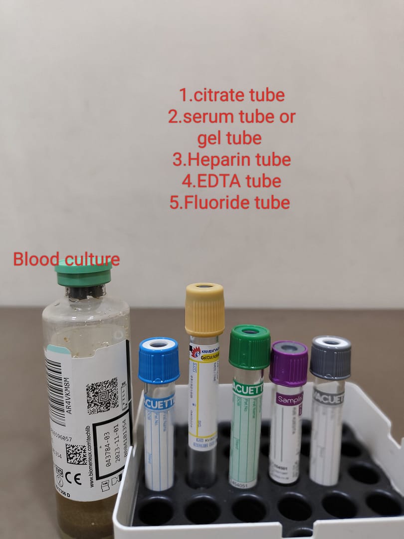 ORDER OF BLOOD DRAW IN PHLEBOTOMY-CLSI GUIDELINES