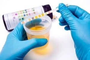 pus cells in urine