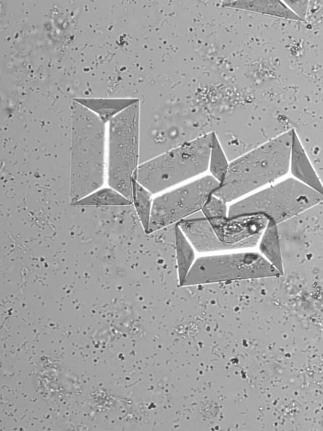 Quick revision of normal urinary crystals