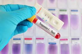 TROPONIN I, Test for heart attack