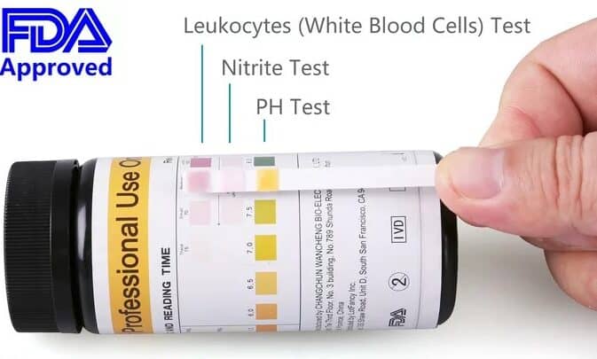 leucoesterase positive on dipstick