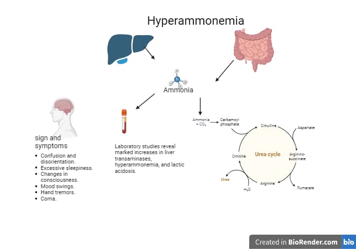 BLOOD AMMONIA LEVEL TESTING Clinical Laboratory Guide